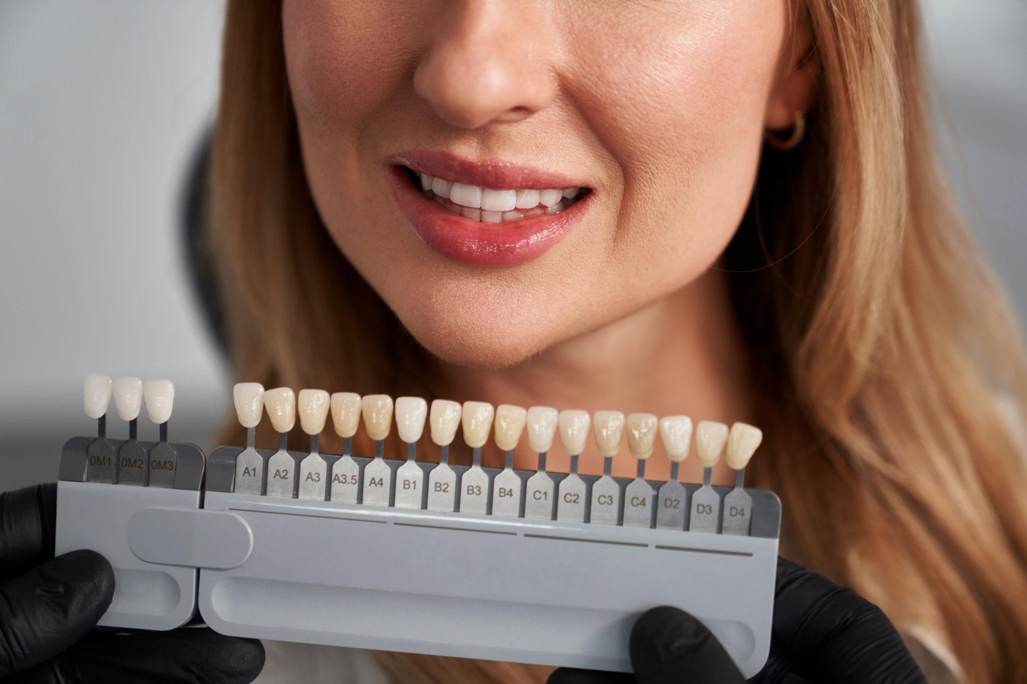 Cosmetic dental procedure