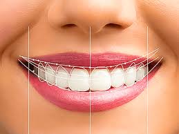 Smile design planning