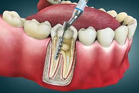Dental diagnosis