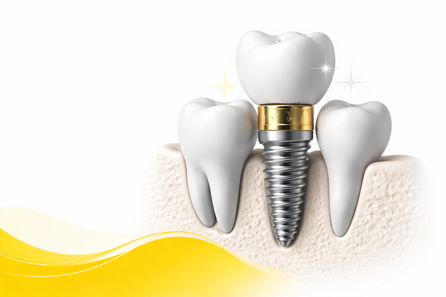 Dental implant consultation at Whiteberry Dental Clinic