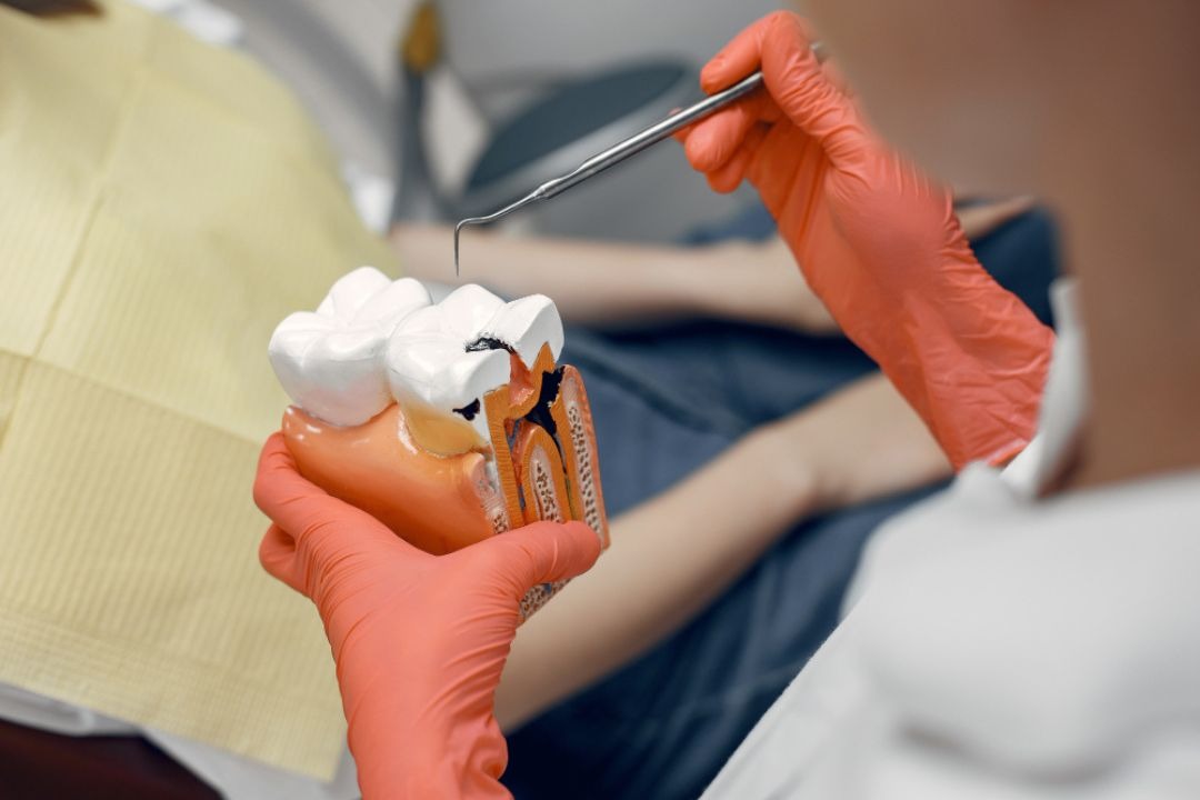 Root canal treatment service at Whiteberry Dental Clinic