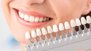 Shade check before whitening