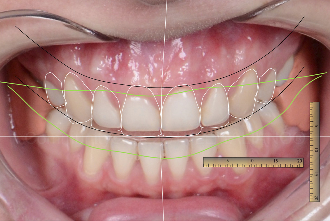 Smile analysis appointment