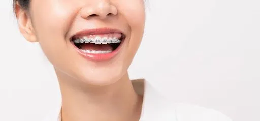 Orthodontic assessment